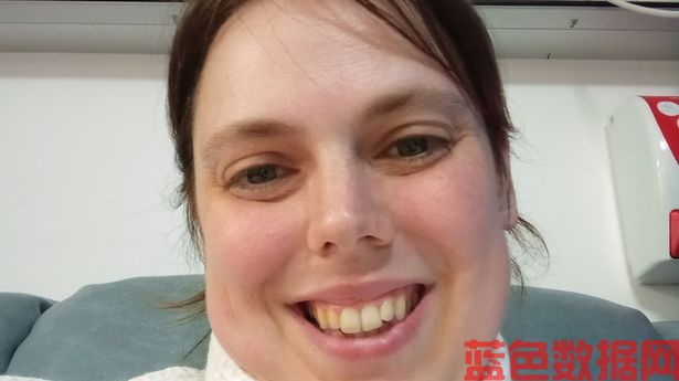 新娘在婚礼当天尿了自己，她说在注射肉毒杆菌后终于感觉“正常”了